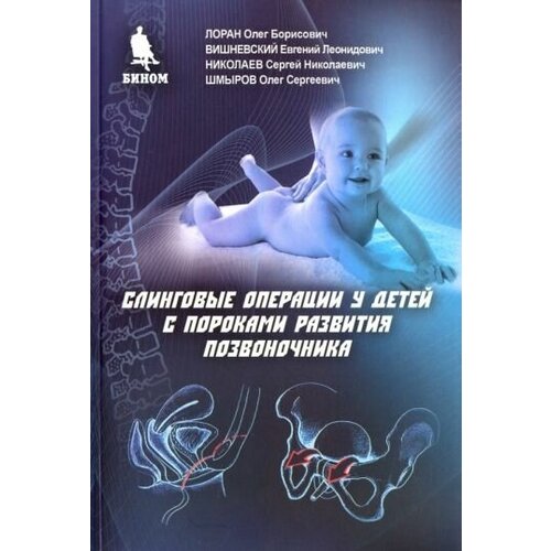 Лоран, николаев, шмыров: слинговые операции у детей с пороками развития позвоночника