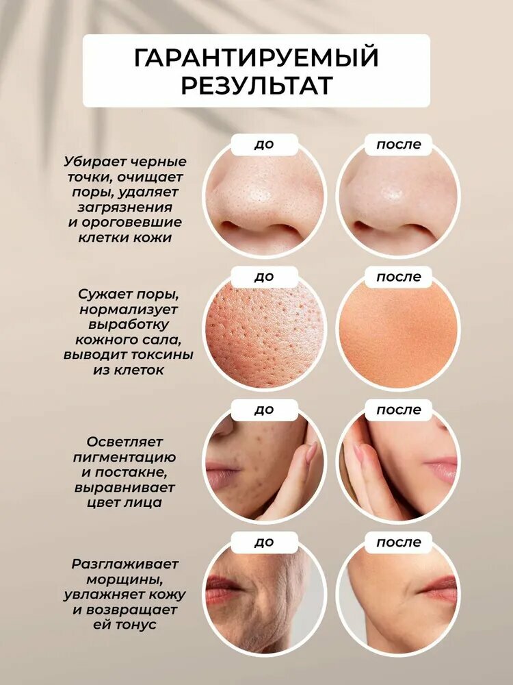 Приборы Для Чистки Лица Xiaomi Xiaomi Ультразвуковая чистка