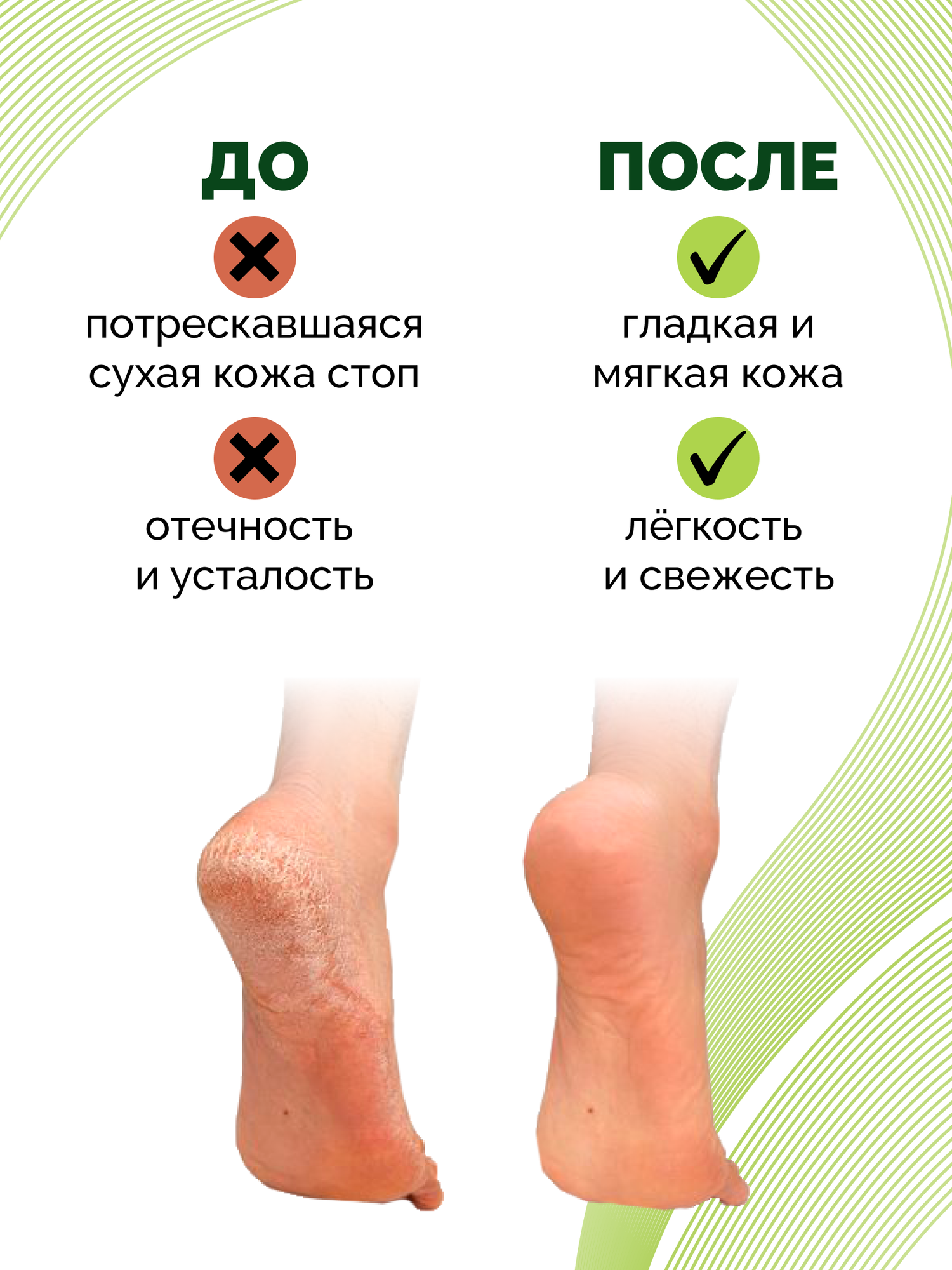 Крем-бальзам для ног AL ARMY, 75 мл — фото 1