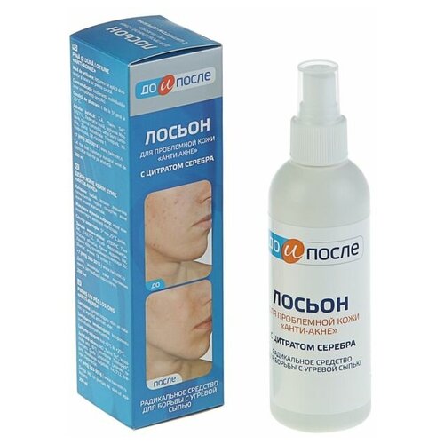 До и После Лосьон 