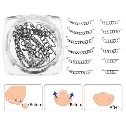 Корректор фиксатор для вросших ногтей 10 шт прозрачный корректор для выпрямления вросших ногтей