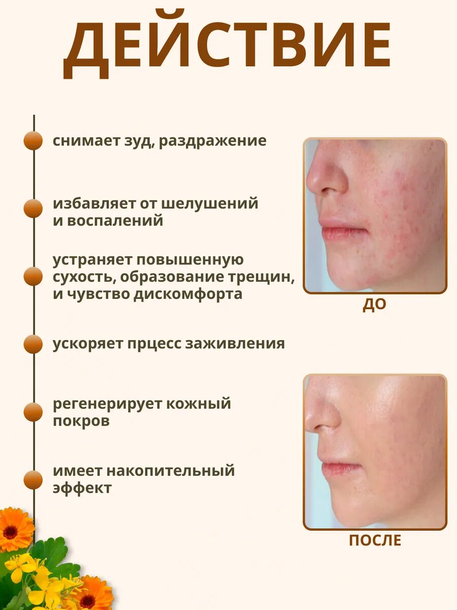 Изображение Мазь Алтайская SIBERIA-SHOP "АЛТ-ПСОРИ", от псориаза, экземы, дерматита с экстрактом чистотела, живицей кедровой, 100 мл