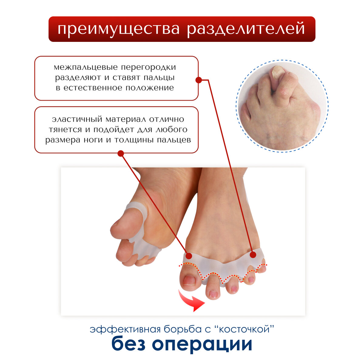 Изображение Силиконовые межпальцевые разделители MyBalance белый силикон