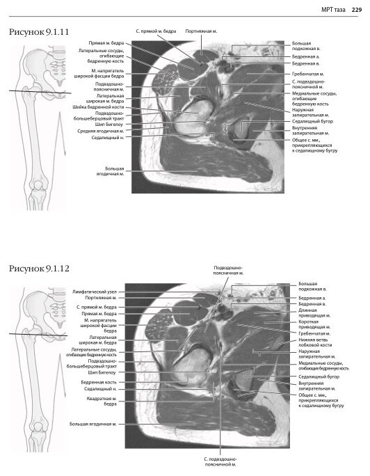 МРТ и КТ. Секционная анатомия (Марк В. Андерсон, Майкл Дж. Фокс) - фото №11