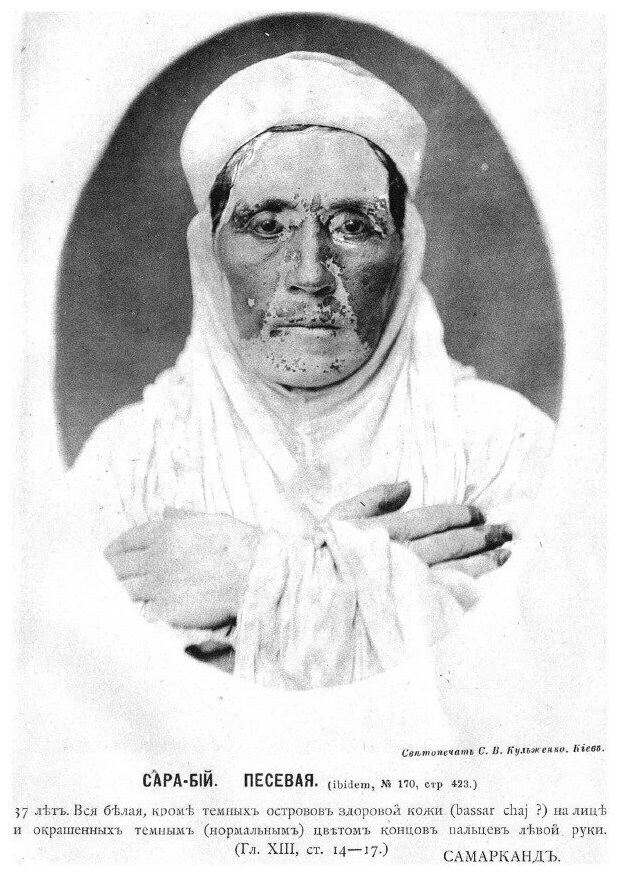 Книга Проказа lepra arabum на юге России - фото №4