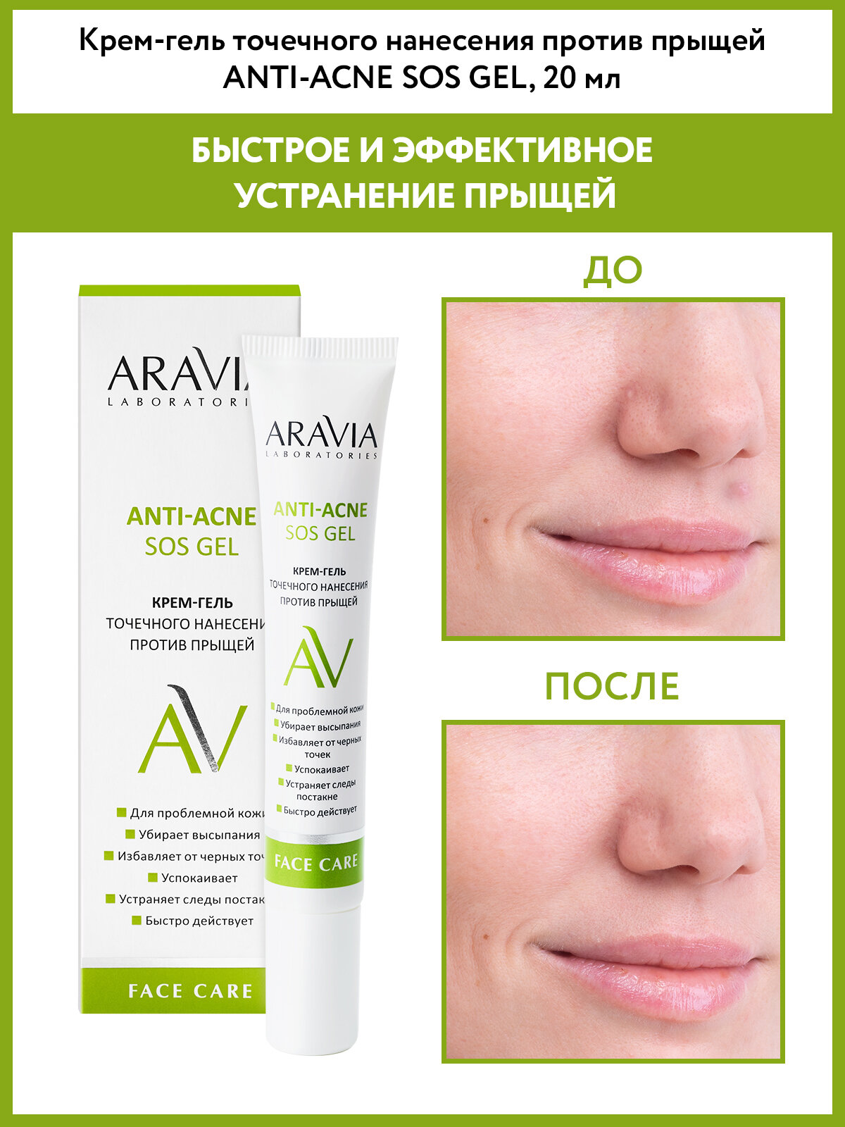 ARAVIA Крем-гель точечного нанесения против прыщей Anti-Acne SOS Gel, 20 мл