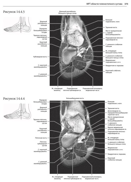 МРТ и КТ. Секционная анатомия (Марк В. Андерсон, Майкл Дж. Фокс) - фото №3