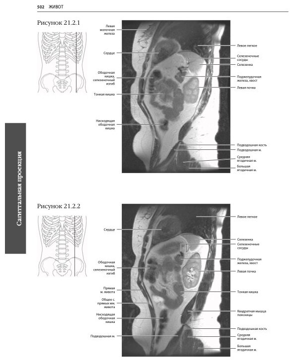 МРТ и КТ. Секционная анатомия (Марк В. Андерсон, Майкл Дж. Фокс) - фото №12