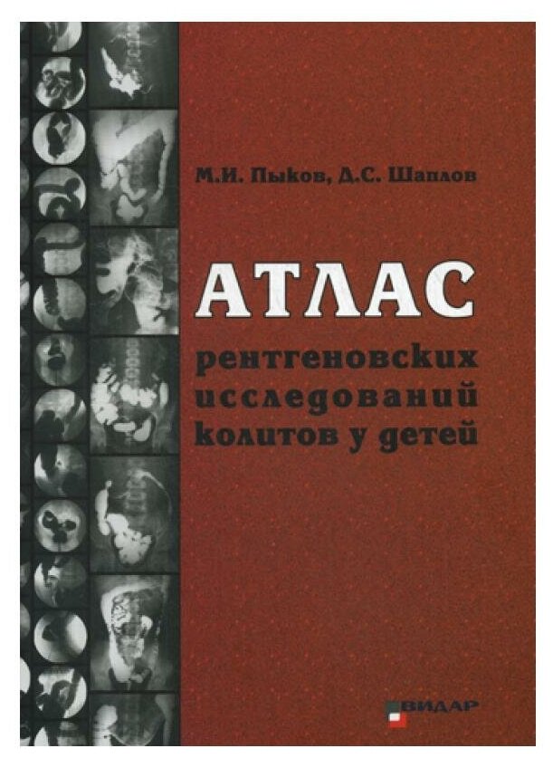 Атлас рентгеновских исследований колитов у детей: учебное пособие