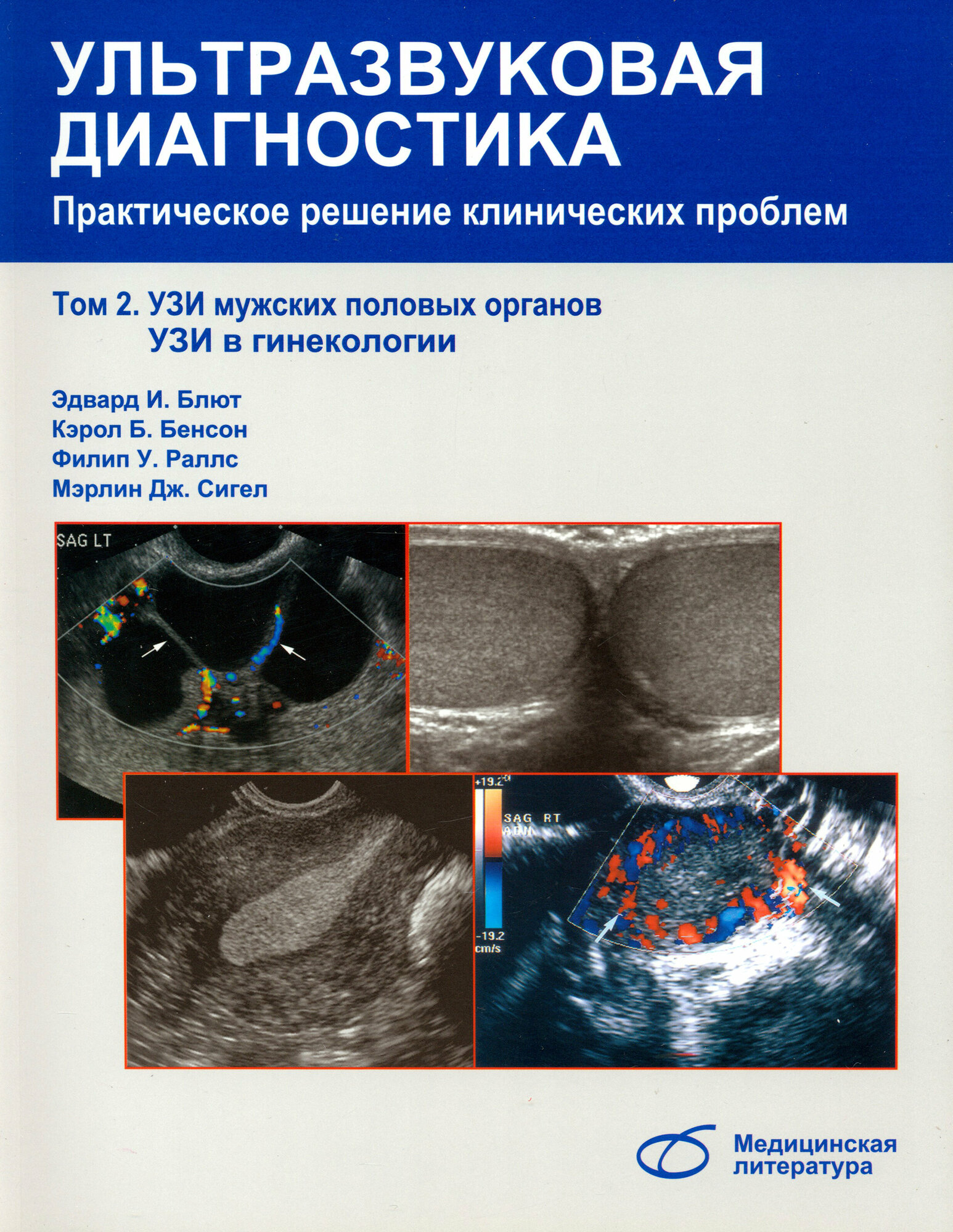 Ультразвуковая диагностика. Практическое решение клинических проблем. Том 2 | Блют Эдвард И.
