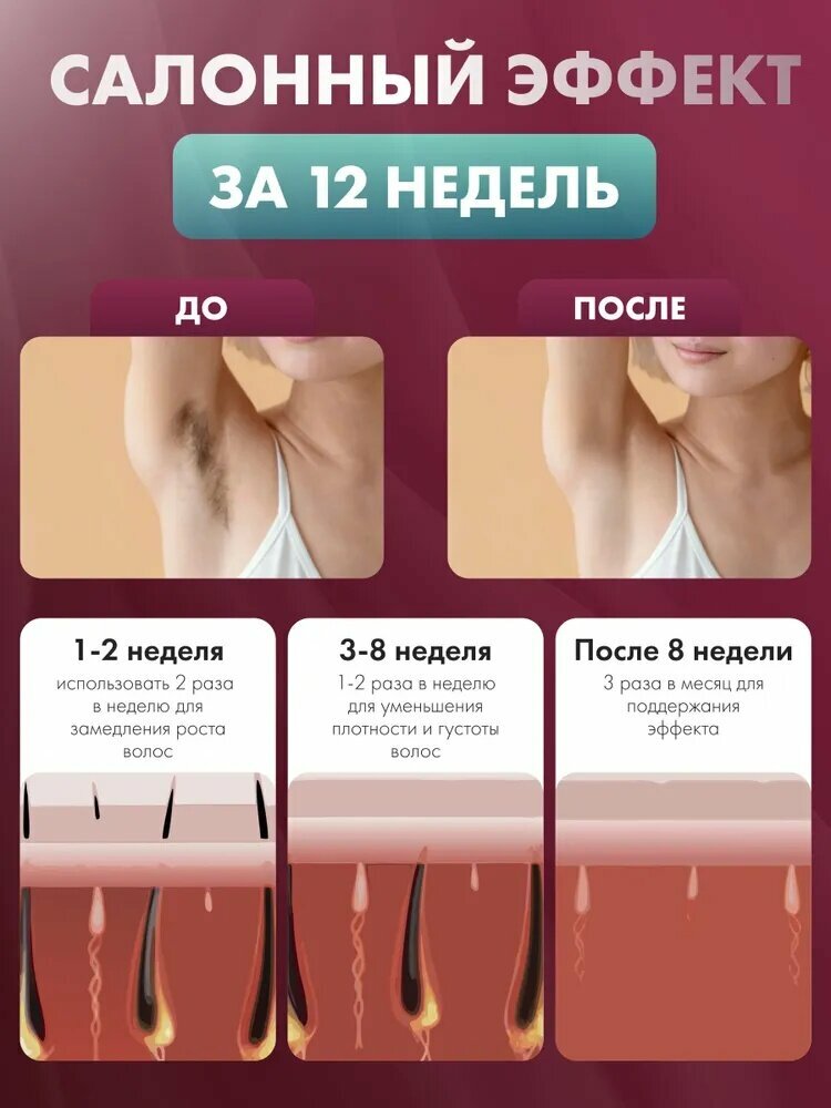 Сравнение коробочных версий фотоэпилятора для розничных сетей: комплектация и наличие фирменных гарантийных стикеров