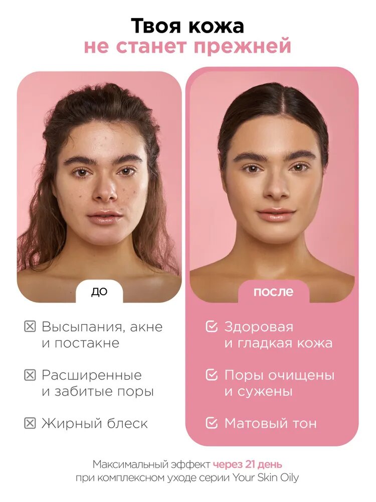 MIXIT Крем для лица от прыщей и жирного блеска матирующий YOUR SKIN — фото 1