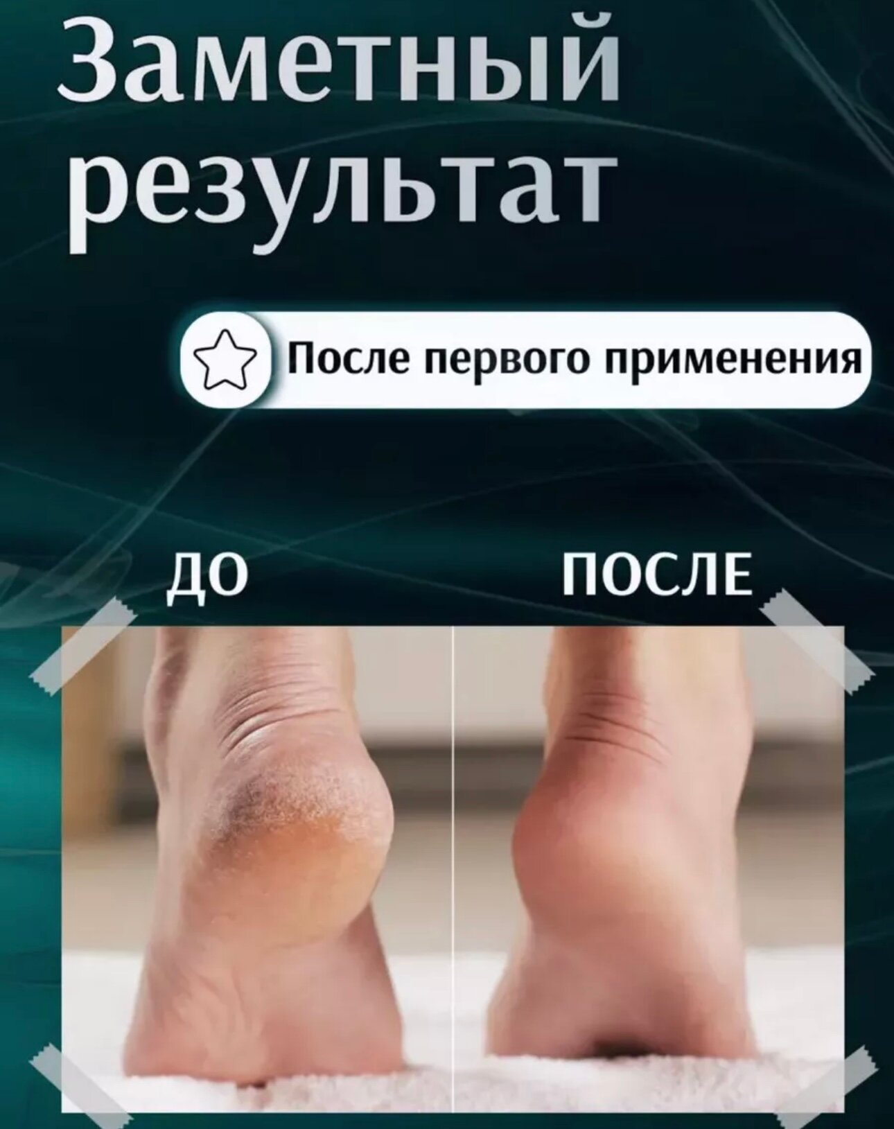Нано-терка с ручкой, случайный цвет — фото 1