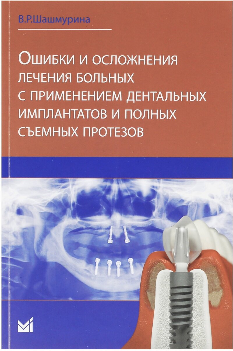 Ошибки и осложнения лечения больных с применением дентальных имплантатов и полных съемных протезов, Шашмурина В. Р.