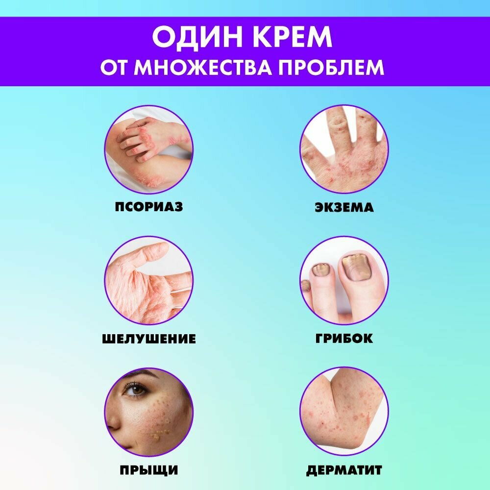 Изображение Алтайская мазь от экземы, псориаза, дерматита Алтайское чудо Псоримазил. ЛУЧИКС