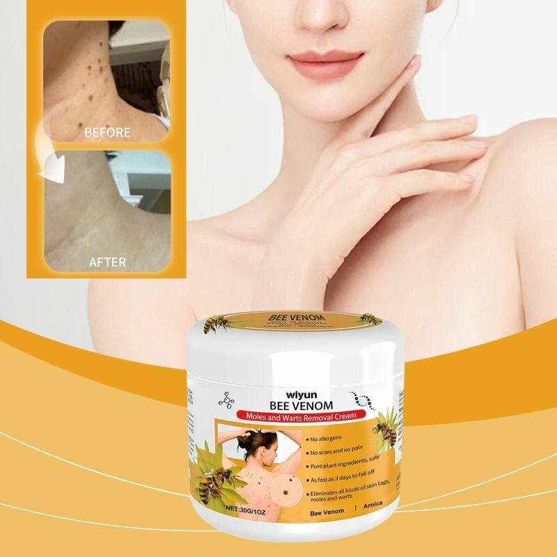 Крем для ухода за бородавками WIYUN Bee Venom мягко очищает, удаляет бородавки, увлажняет и разглаживает кожу.