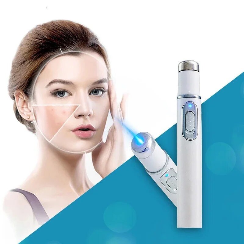 Лазерная ручка для лечения варикозного расширения вен, голубого цвета, Acne removing pen — фото 1