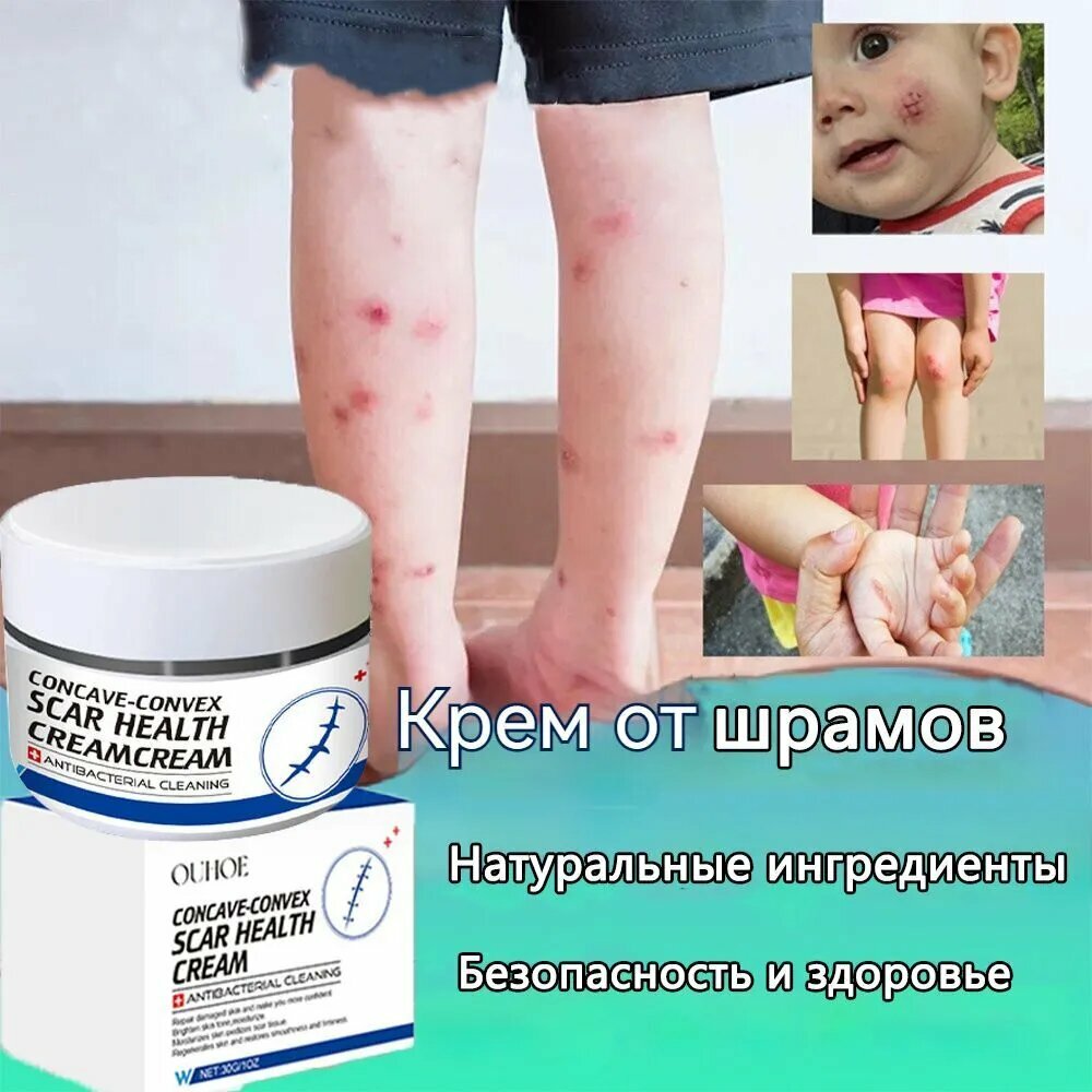Крем от шрамов и рубцов от растяжек для беременных быстрая починка рубцов прыщей 30г