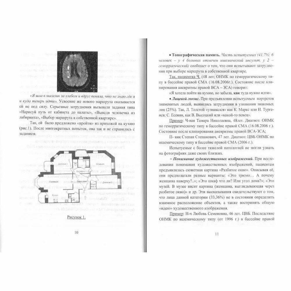 Нарушения высших психических функций и их восстановление при поражениях правого полушария мозга - фото №3