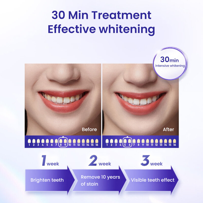 Изображение Отбеливающие полоски для зубов Crest 3D Whitestrips Professional Effects - 7шт