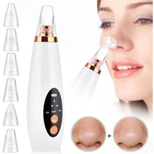 Аппарат вакуумной чистки кожи лица и пор от черных точек 6 насадок 56000₽