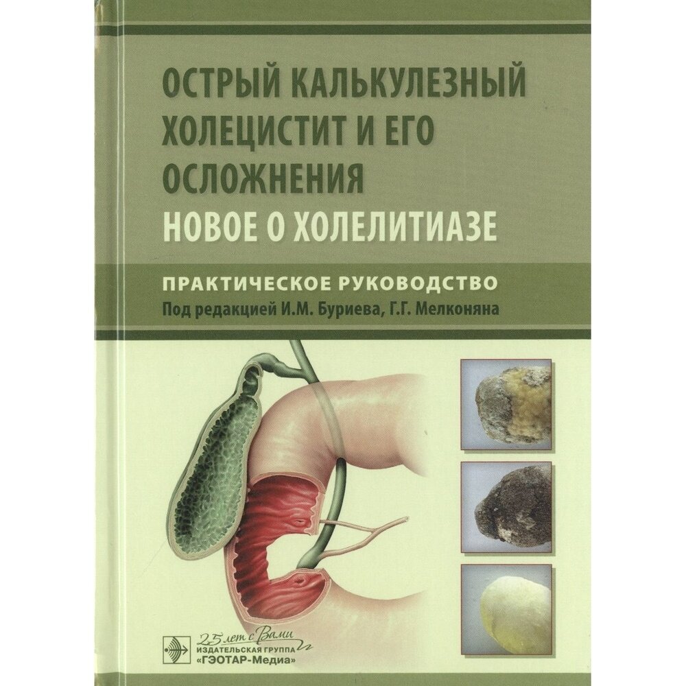Острый калькулезный холецистит и его осложнения. Новое о холелитиазе. Руководство - фото №2