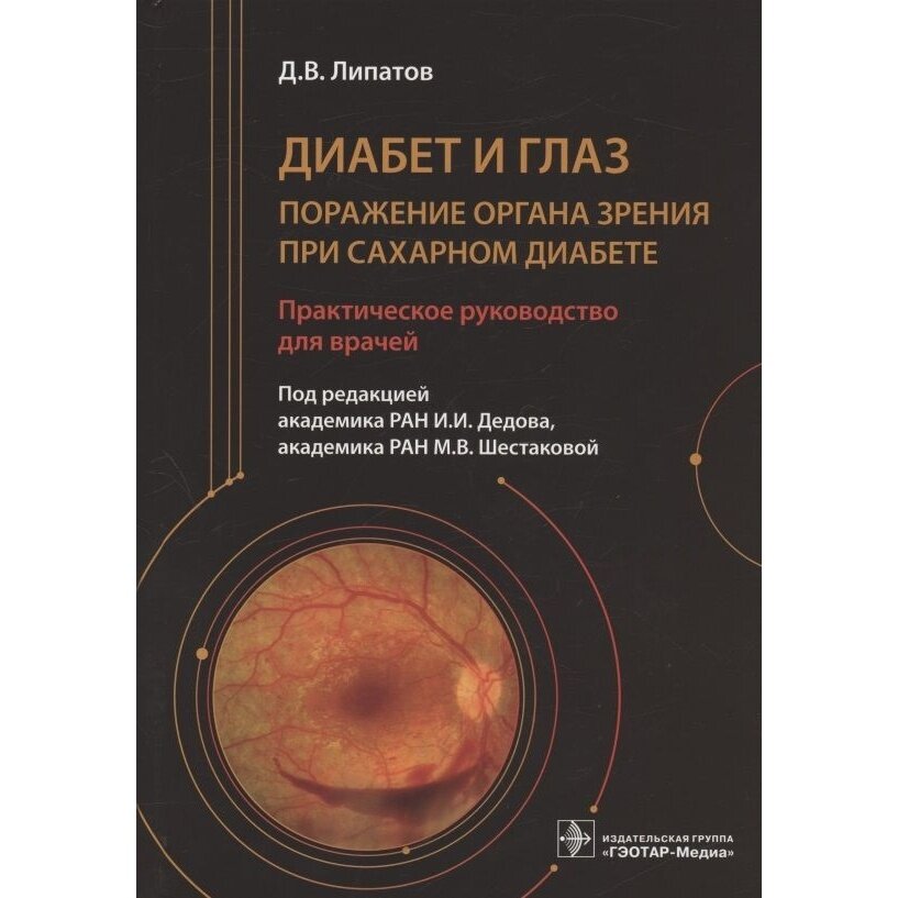 Диабет и глаз. Поражение органа зрения при сахарном диабете - фото №2