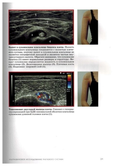 Книга Учебник ультразвуковых исследований костно-мышечной системы - фото №9