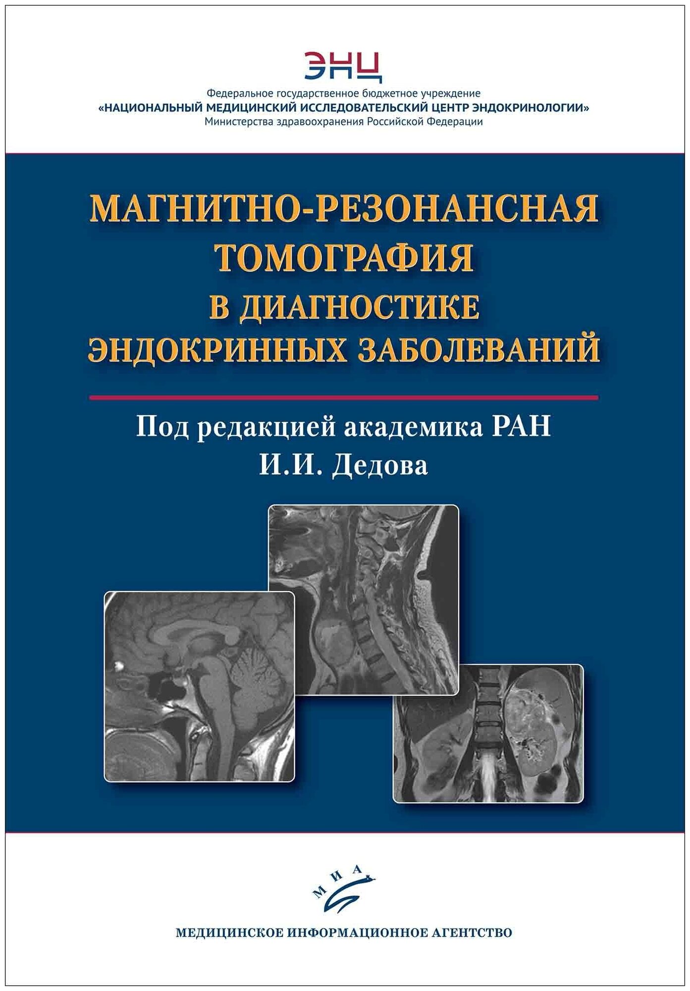 Книга Магнитно-резонансная томография в диагностике эндокринных заболеваний - фото №1