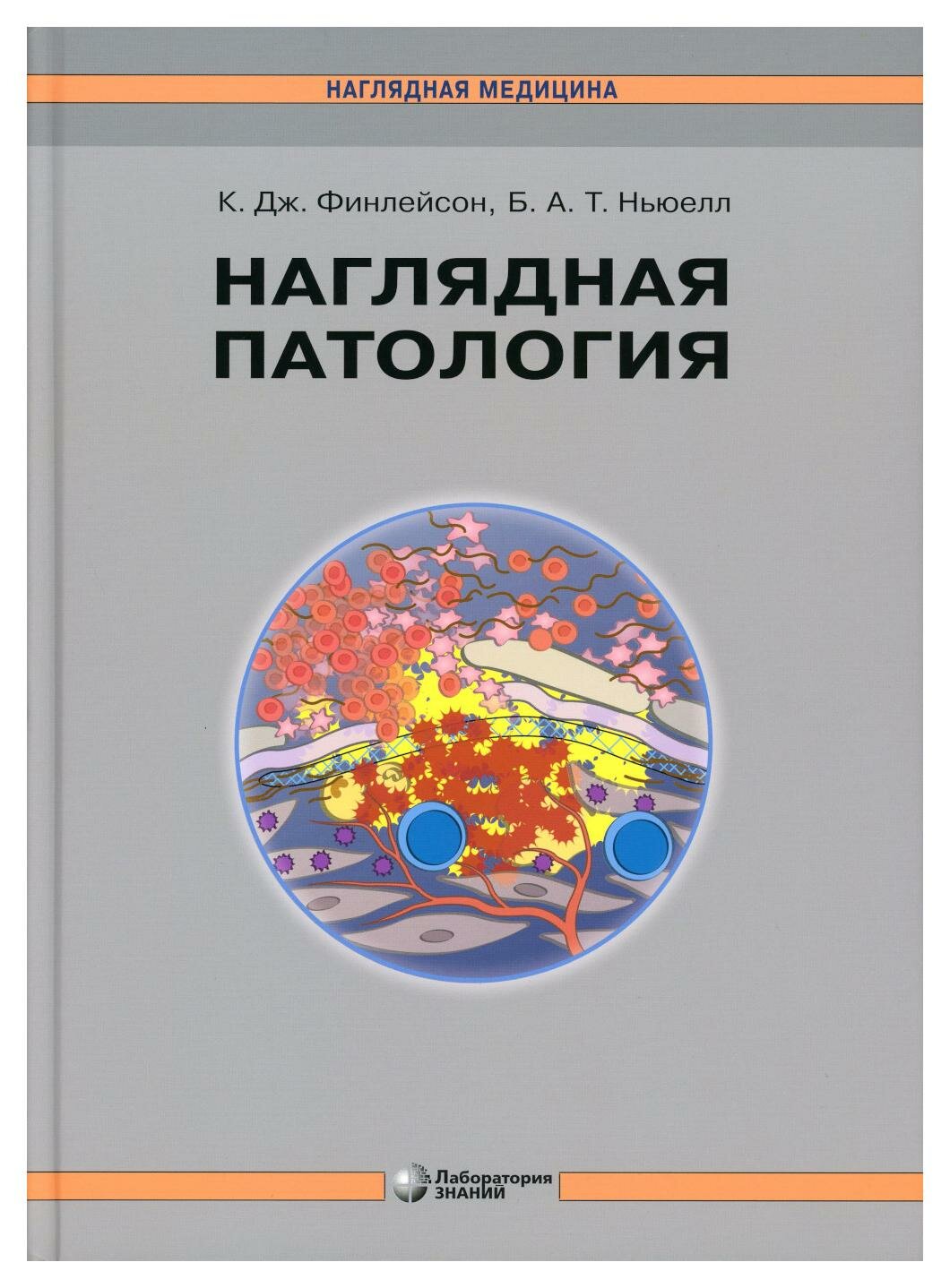 Наглядная патология (Финлейсон К. Дж., Ньюелл Барри А. Т.) - фото №4