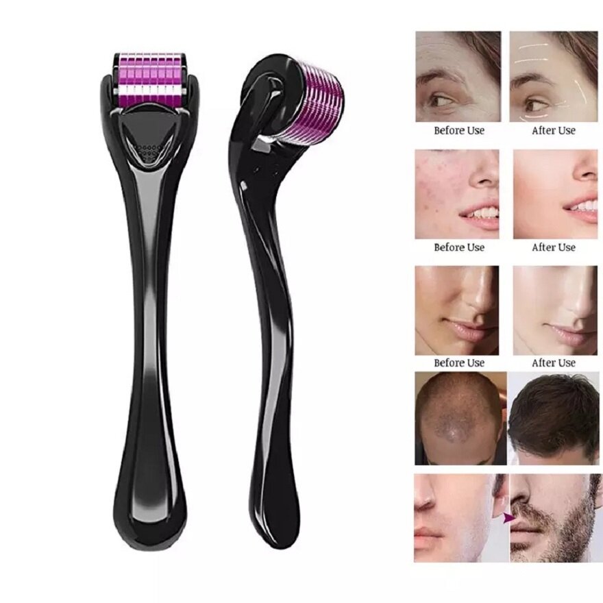 Аксессуары Мезороллер "Derma rolller system" для лица, волос и бороды 540 игл по 0,5 мм — фото 1