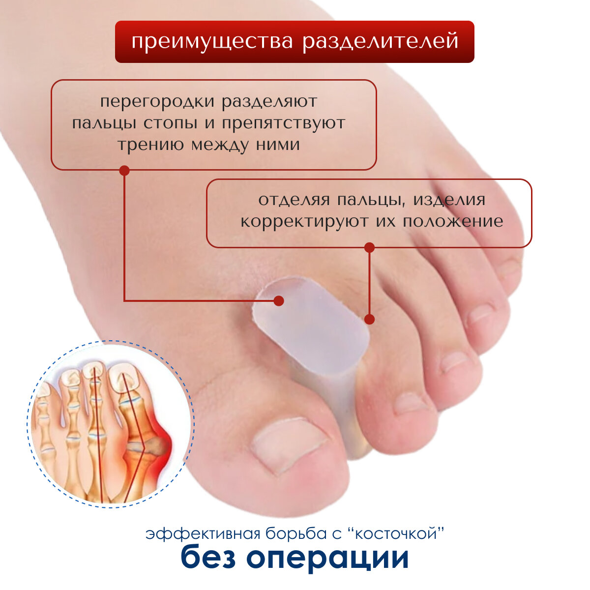 Изображение Разделитель для пальцев MyBalance, при деформации пальцев, белый, силиконовый, 2 шт, размер M