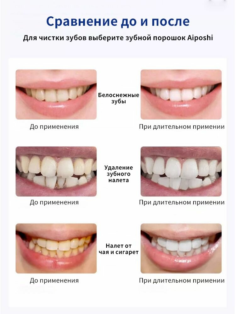 Отбеливающий зубной порошок, Быстро удалить желтый зубной камень, устраняет неприятный запах изо рта, уменьшает язвы во рту и ухаживает за деснами, укрепляет десна, 50 г — фото 1