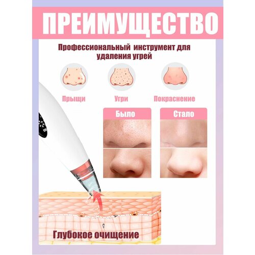 Вакуумный очиститель пор аппарат для чистки лица от прыщей и черных точек 699₽