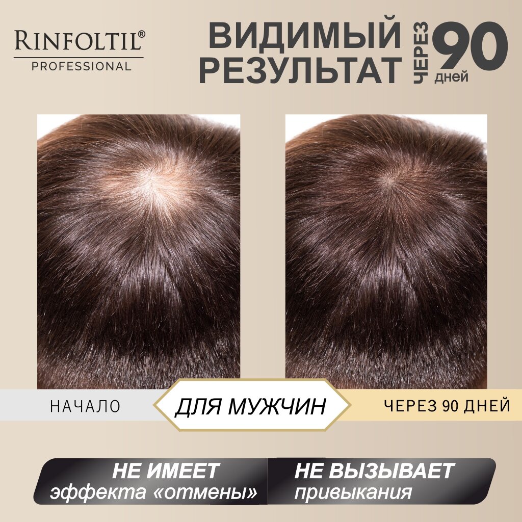 Ринфолтил Сереноа лосьон для мужчин Rinfoltil Serenoa for Men фл. 10мл №10 Вектор-Медика АО - фото №6