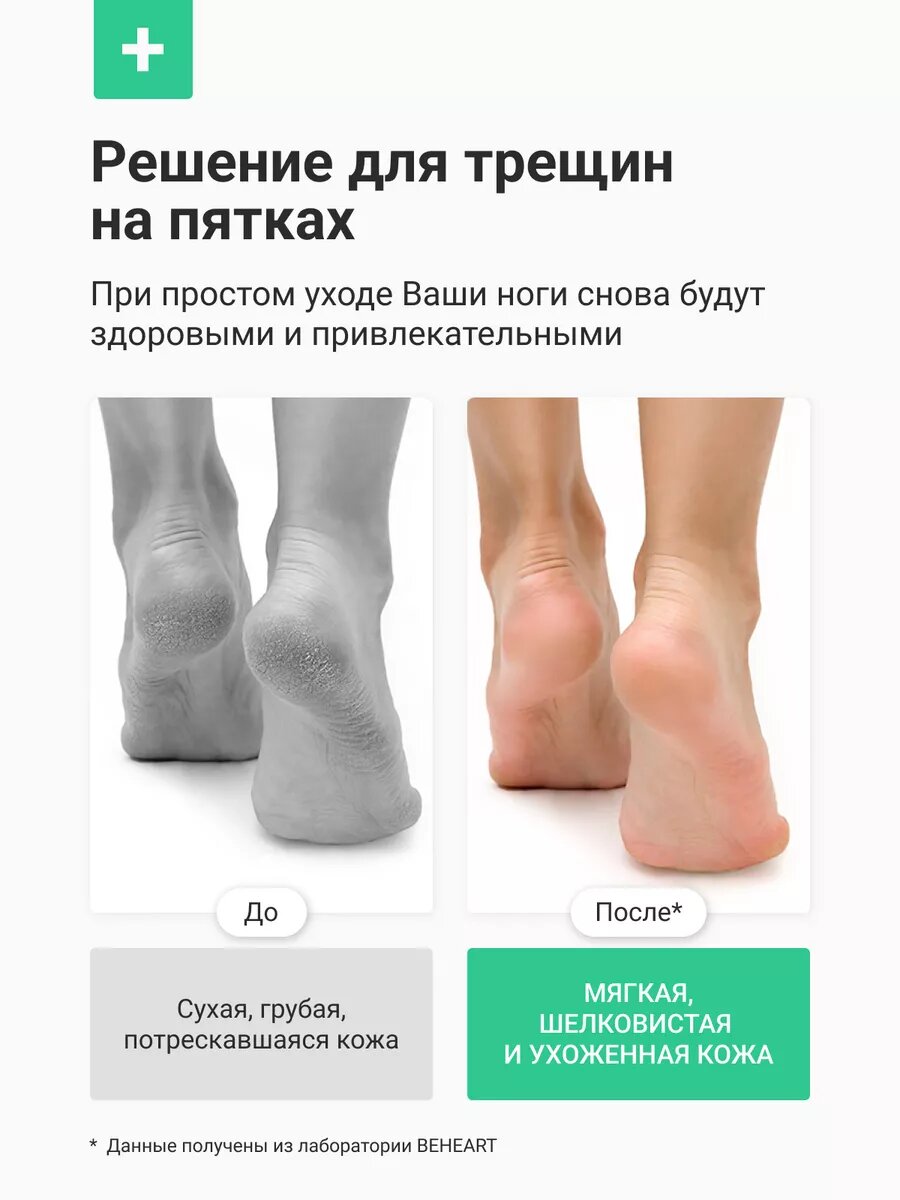 Пилки Электрические Электрическая пилка BeHeart M10, для пяток, IPX6, 3 скорости, 1500 мА, белая.
