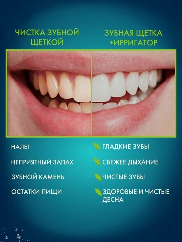 Ирригатор портативный h2ofloss с чехлом/ 8 насадок.