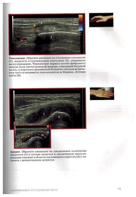 Книга Учебник ультразвуковых исследований костно-мышечной системы - фото №8
