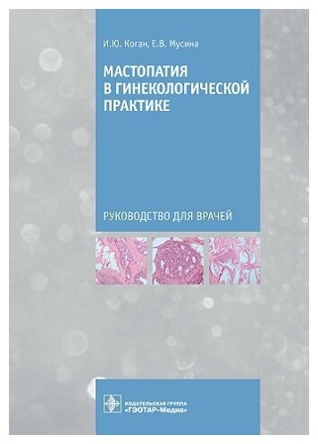 Мастопатия в гинекологической практике. Руководство