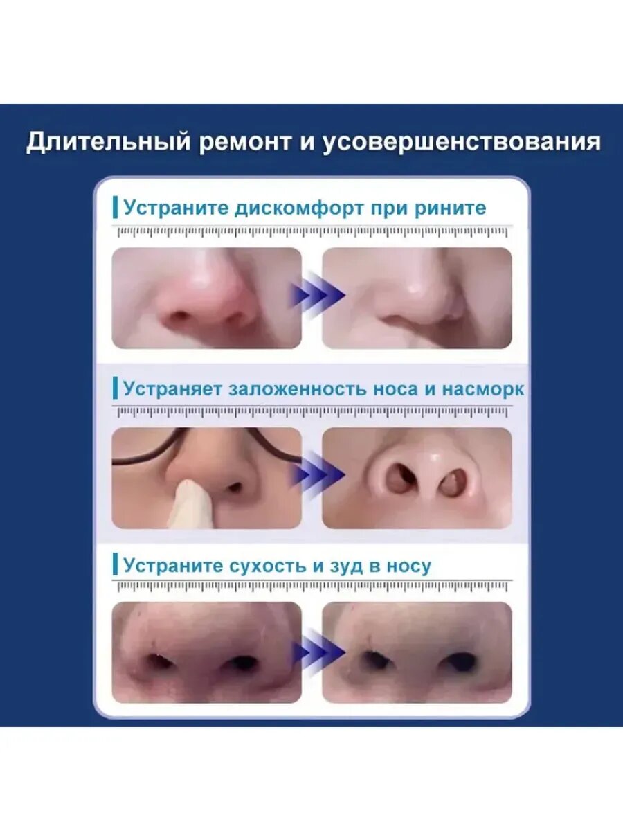 Изображение Пластырь ингалятор от насморка (10 шт.)
