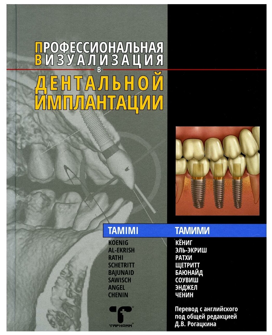 Книга Профессиональная визуализация в дентальной имплантации - фото №1