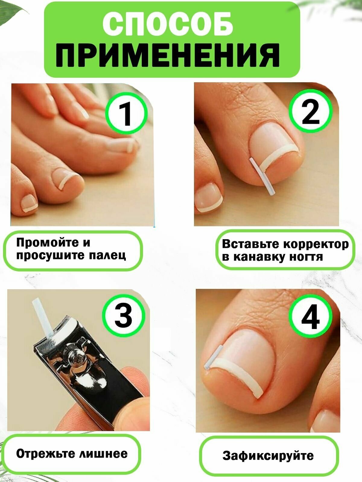 Набор педикюрный от вросшего ногтя QuisLife: Полоски-корректоры для выпрямления ногтей 10 шт — фото 1
