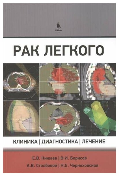 Рак легкого: клиника, диагностика, лечение - фото №1