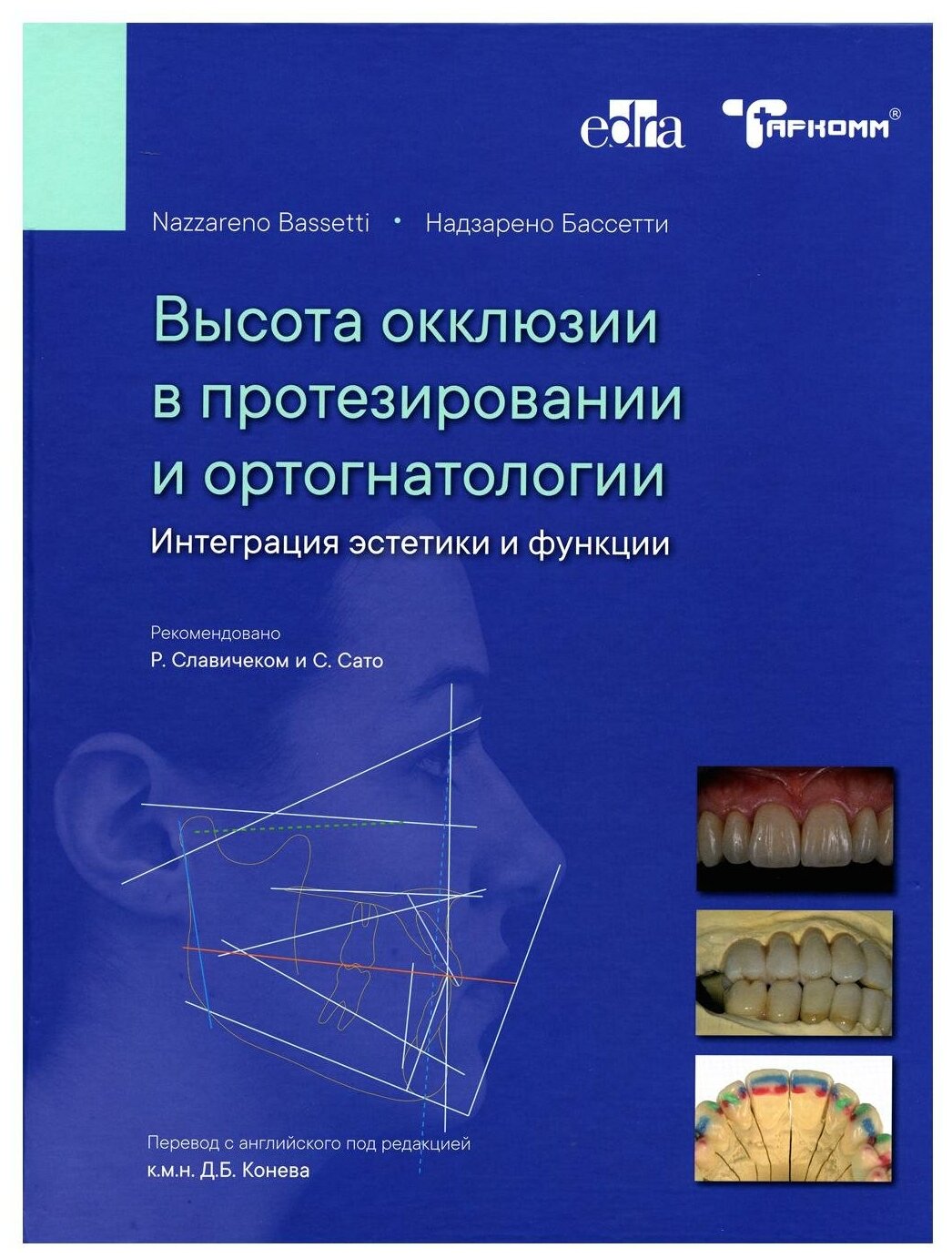 Высота окклюзии в протезировании и ортогнатологии. Интеграция эстетики и функции - Надзарено Бассетти