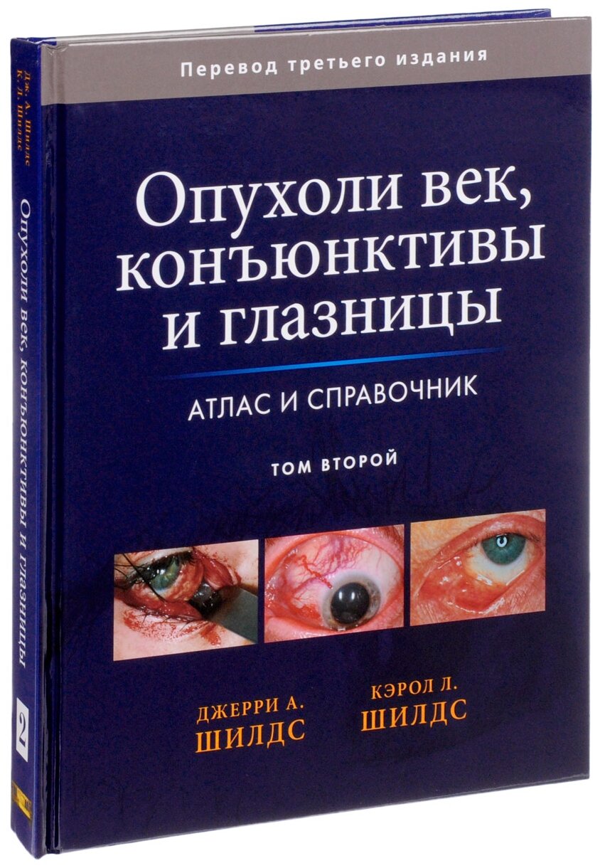 Опухоли век, конъюнктивы и глазницы. Атлас и справочник. В 2-х томах. Том 2 - фото №4