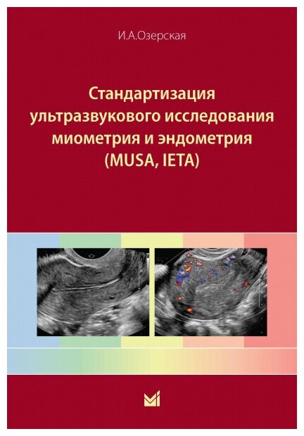 Стандартизация ультразвукового исследования миометрия и эндометрия (MUSA, IETA)