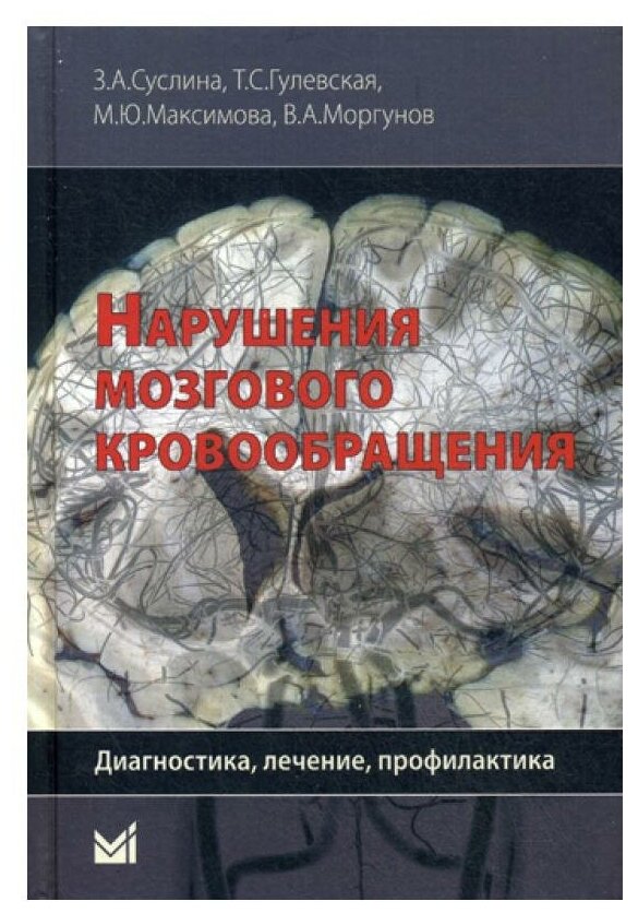 Нарушения мозгового кровообращения. Диагностика, лечение, профилактика - фото №1