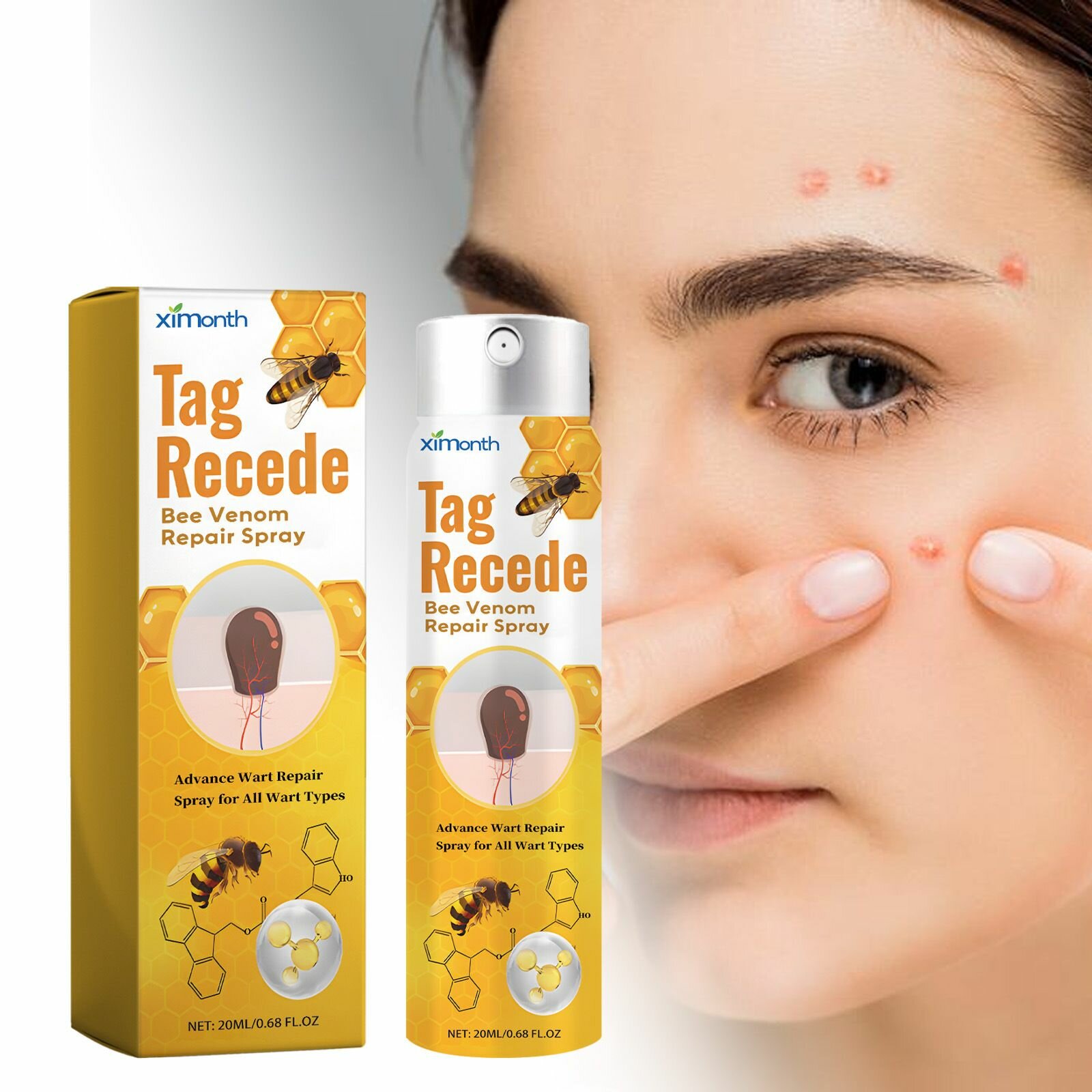 20ML Tag Recede Bee Venom, Средство от папиллом и бородавок, мазь для ухода за кожей 20 мл — фото 1