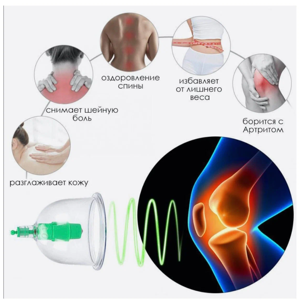 Вакуумные массажные банки - Zhenai pull out a vacuum apparatus (6 шт) - фотография № 3