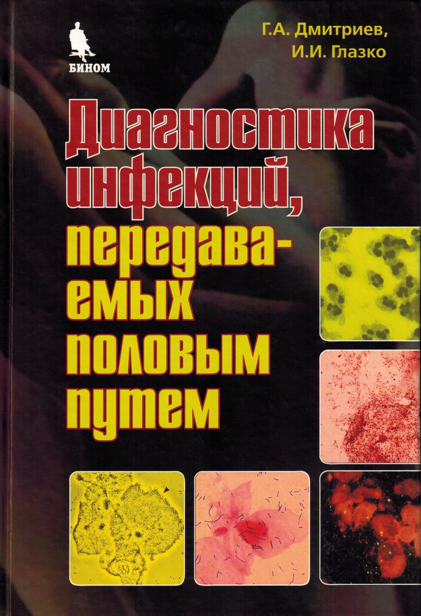 Дмитриев Г. А, Глазко И. И. "Диагностика инфекций, передаваемых половым путем. лабораторная диагностика"